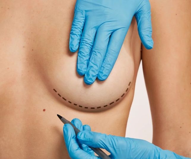 Silicone: respeitar recuperação ajuda a evitar deslocamento da prótese durante o sexo