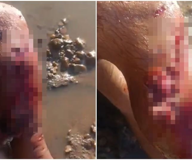 IMAGENS FORTES! Jacaré de mais de seis metros ataca e dilacera perna de pescador em lago no Pará. VEJA VÍDEOS