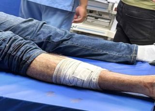 Capitão da Polícia Militar é atingido com tiro na perna durante evento de campanha do govenador Roberto Cidade no bairro Novo Israel, Zona Norte de Manaus