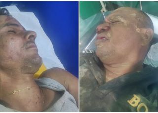 Hospital procura familiares de dois homens que sofreram acidentes graves e estão internados no hospital de Iranduba, Região Metropolitana de Manaus