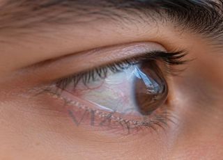 SUS passa a oferecer cirurgia que trata glaucoma e catarata em um único procedimento