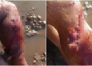 IMAGENS FORTES! Jacaré de mais de seis metros ataca e dilacera perna de pescador em lago no Pará. VEJA VÍDEOS