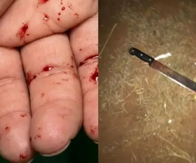 IMAGENS FORTES! Mulher tem mão arrancada com facão durante briga com o ex-marido. VEJA VÍDEO