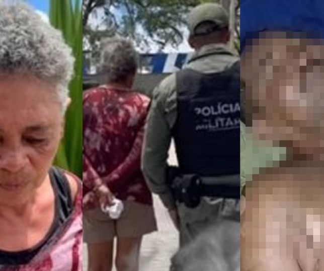 IMAGENS FORTES! Mulher é presa após jogar água fervente no marido durante discussão em Caruaru. VEJA VÍDEO