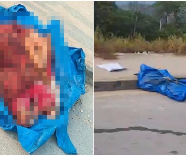 IMAGEM FORTE! CENA MACABRA! Populares encontram corpo esquartejado na Avenida Margarita, bairro Cidade de Deus, Zona Norte de Manaus. VEJA VÍDEO