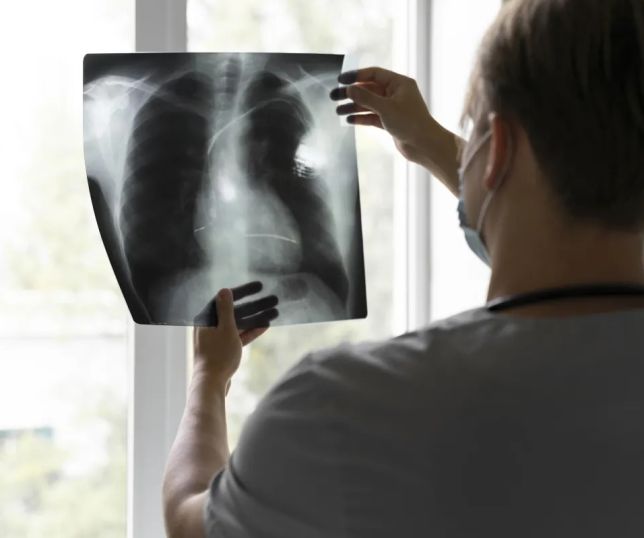 Anvisa aprova nova terapia-alvo para câncer de pulmão avançado; tratamento busca combater tumor com mais precisão