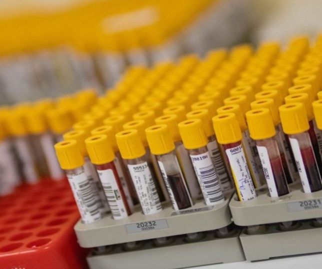 Estudo brasileiro identifica dez proteínas no sangue que podem antecipar risco de hipertensão pulmonar