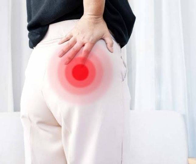 Síndrome do piriforme: entenda a condição que provoca dor intensa nos glúteos