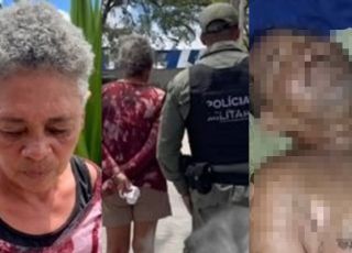 IMAGENS FORTES! Mulher é presa após jogar água fervente no marido durante discussão em Caruaru. VEJA VÍDEO