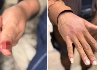Macaco-prego invade casas, fere cinco pessoas e entra em residência onde estava bebê de 5 dias