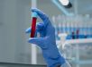 Novo exame de sangue que busca detectar mais de 50 tipos de câncer chega ao Brasil