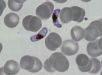 Parasita da malária usa hormônio do sono para sincronizar seu desenvolvimento no organismo humano